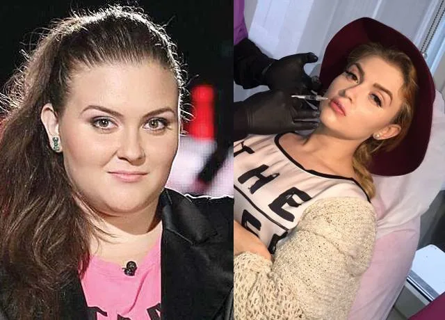 Oana Radu a slăbit 65 de kilograme și a trecut prin 5 operații estetice. Cum arăta înainte să fie celebră. Tranformare incredibilă!
