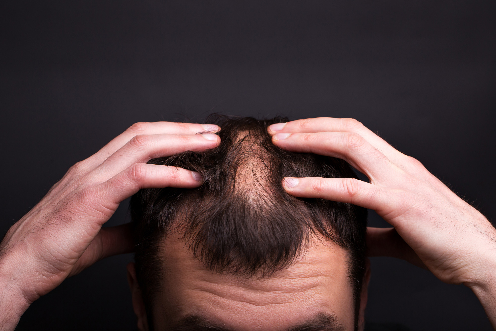 Tratament de top pentru creșterea părului natural, fără minoxidil și fără efecte adverse