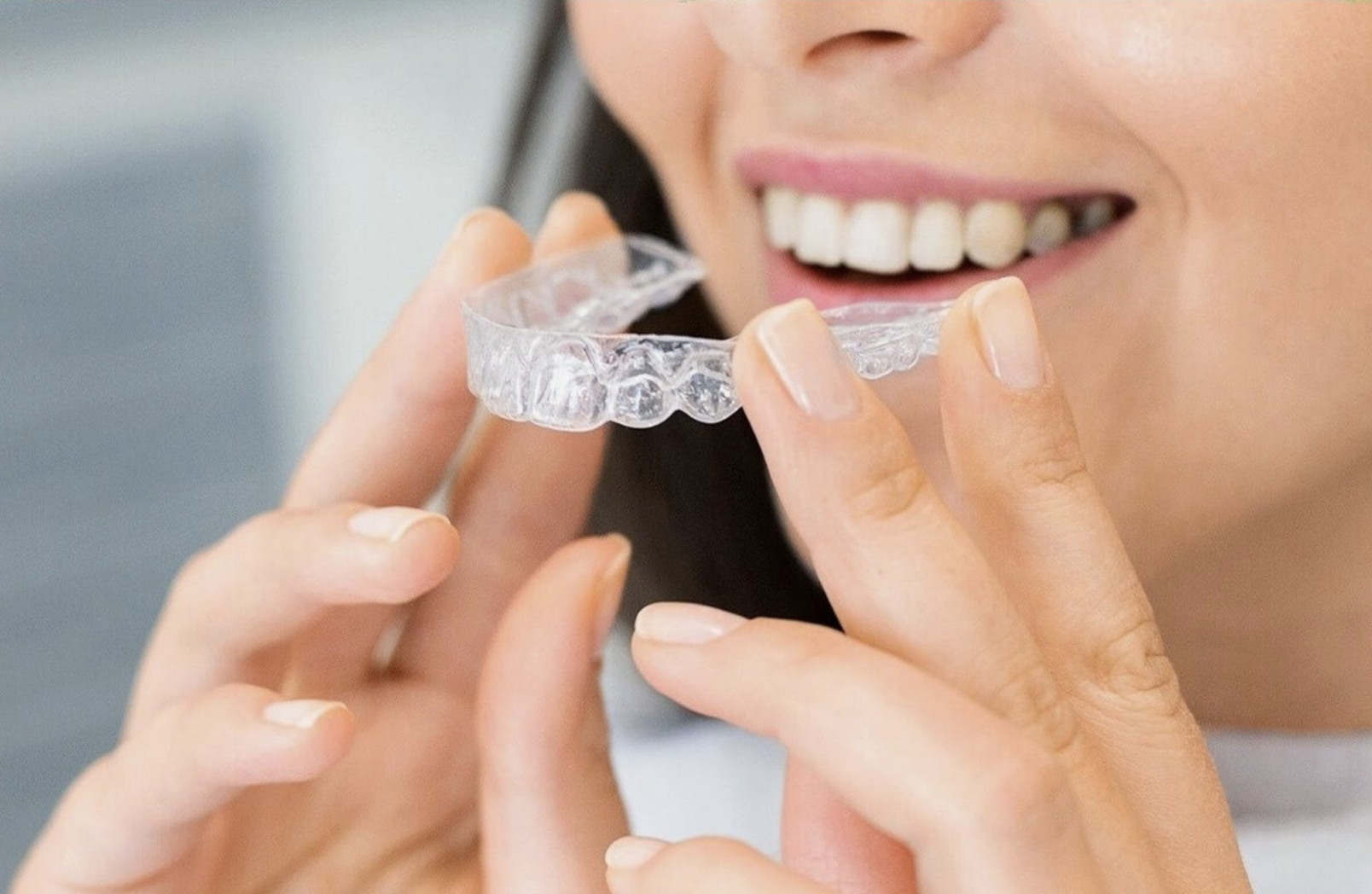Aparat dentar care nu se vede? Află totul despre el