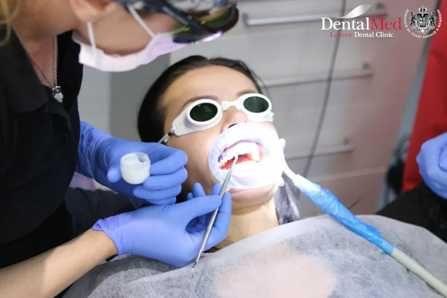 Tot ce trebuie să știi despre albirea dentară